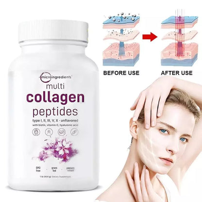 Multi Collagen Complex