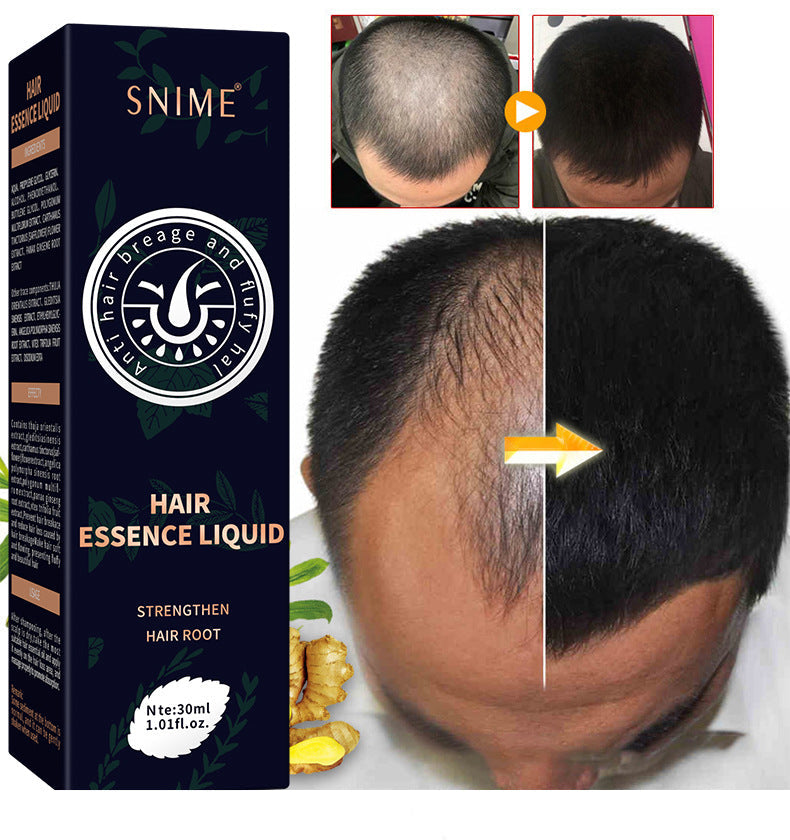 SHIME | Hair growth spray