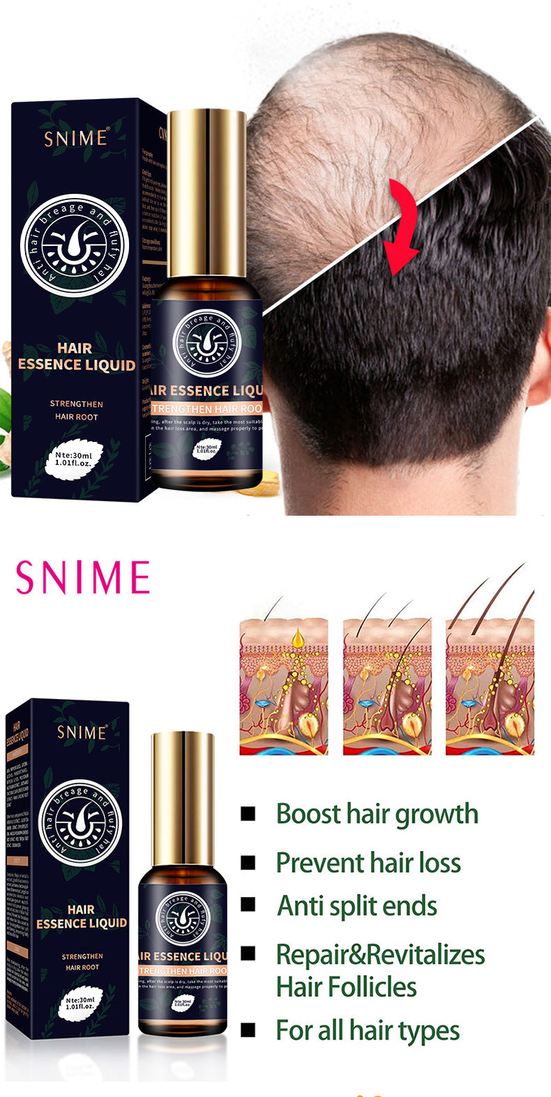 SHIME | Hair growth spray